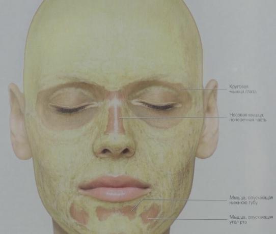 See, kuidas nahaalune rasvkude on jaotatud meie nägu (kollane). Ümmarguse lihased silmade kiht sidekoe sisaldab peaaegu üldse rasva