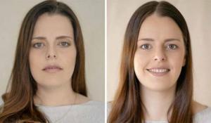 TOP 10 fotot naistest enne ja pärast sünnitust