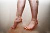 Rikkumise verevoolu jalgades: põhjused, sümptomid