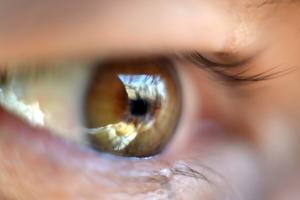 Võrkkesta irdumine silmad: kuidas säästa nägemine?