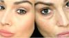5 Vana-retseptid, mis aitavad muuta välimust värske ja elastne nahk silmade ümber ja noored