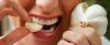 7 viisi, kuidas vabaneda lõhn küüslauk suu