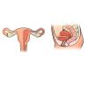 Mis juhtub emakas enne ja pärast sünnitust: mida vajaduste uuring