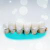 Enim lahastamise hambad: kui palju see tegelikult?