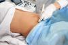 Kui tihti peate raseduse ajal ultraheli tegema, ütleb arst