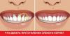 Kuidas ravida igemed kui hambad muutunud palja kaelaga?